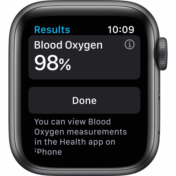 Apple Watch Series 6 40mm (4G) - Viền nhôm dây cao su (Black)