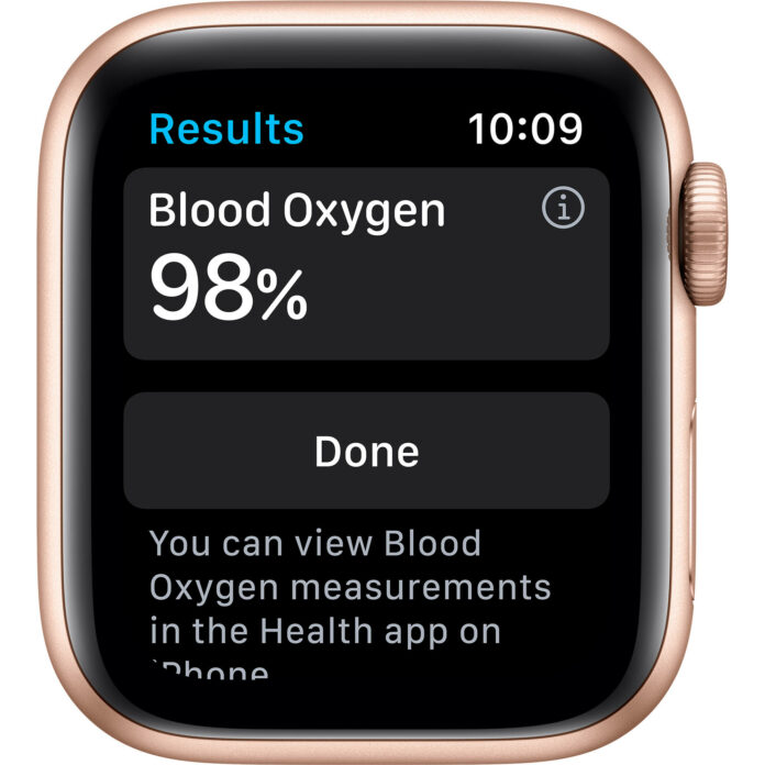 Apple Watch Series 6 40mm (GPS) - Viền nhôm dây cao su (Gold)